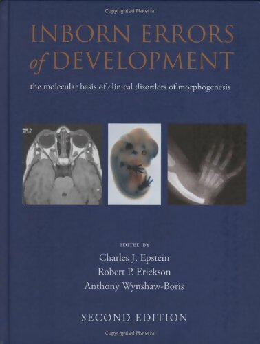 Livrenpoche : Inborn errors of development. The molecular basis of clinical disorders of morphogenesis - Charles J. Epstein - Livre