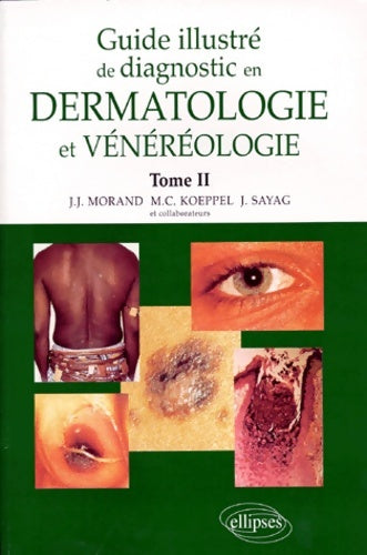 Livrenpoche : Guide illustré de diagnostic en dermatologie et vénéréologie Tome II - Jean-Jacques Morand - Livre