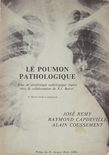 Le poumon pathologique : Atlas de séméiologie radiologique - José Rémy - Livre