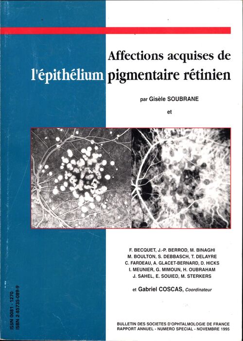 Affections acquises de l'épithélium pigmentaire rétinien - Gisèle Soubrane - Livre
