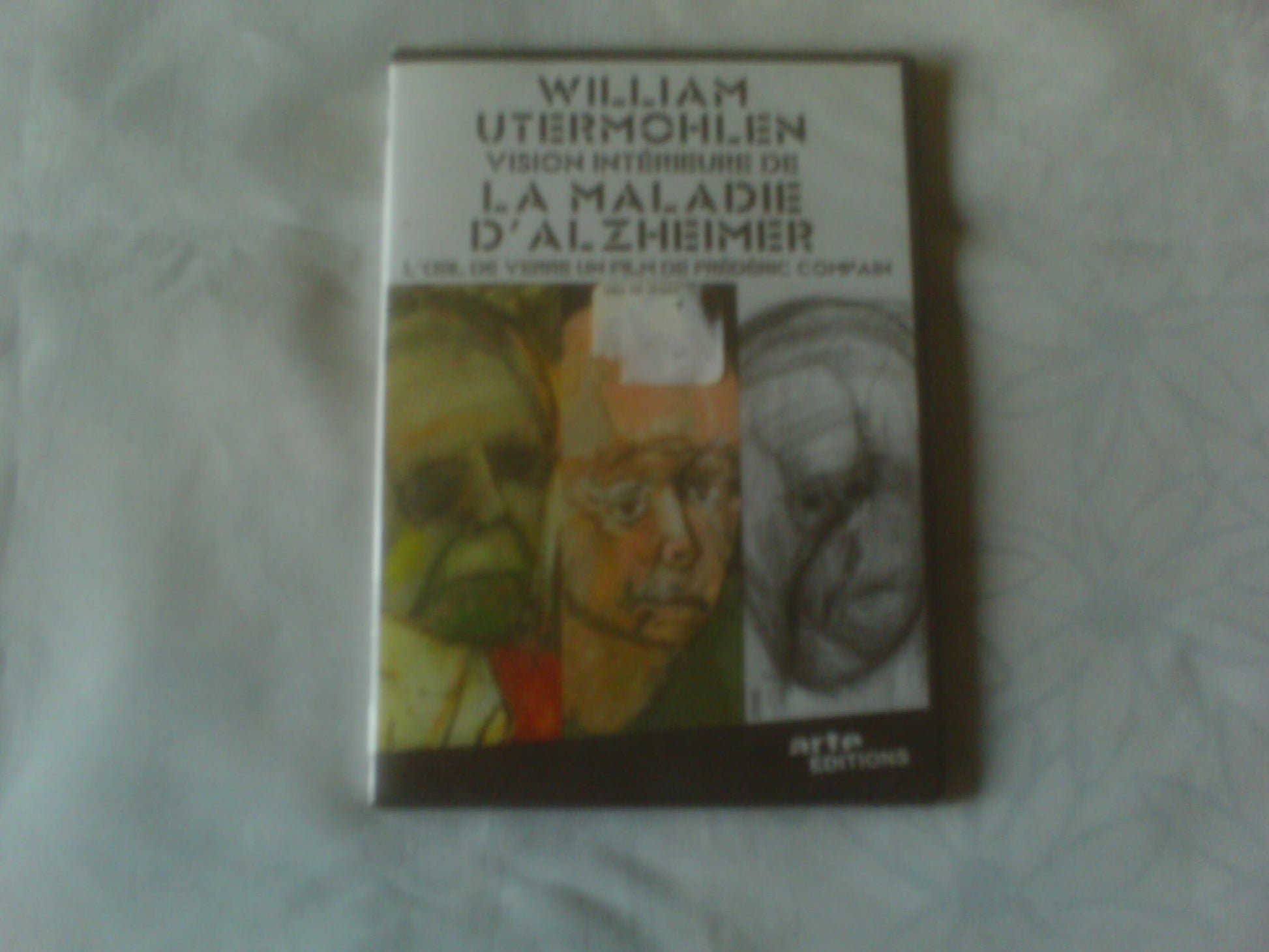 Livrenpoche : L'oeil De Verre - William Utermohlen, Vision Intérieure De La Maladie D'alzheimer - XXX - DVD