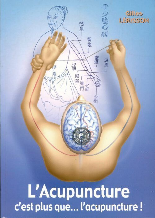 Livrenpoche : L'acupuncture c'est plus que... l'acupuncture - Gilles Lerisson - Livre