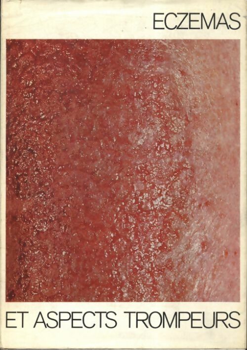 Livrenpoche : Eczémas et aspects trompeurs - Wolfgang Müller - Livre