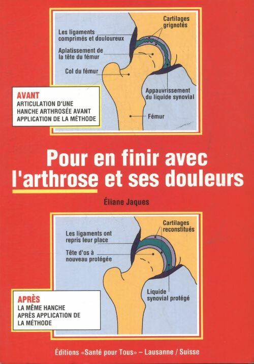 Livrenpoche : Pour en finir avec l'arthrose et ses douleurs - Eliane Jacques - Livre