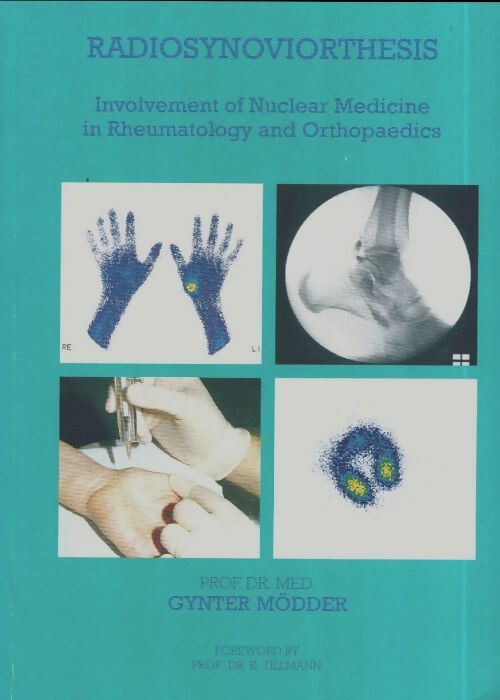 Livrenpoche : Radiosynoviorthesis Involvement of nuclear medicine in rheumatology and orthopaedics - Gynter Mödder - Livre