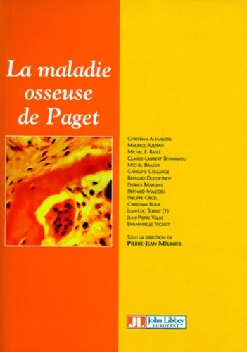 Livrenpoche : La maladie osseuse de Paget - Collectif - Livre