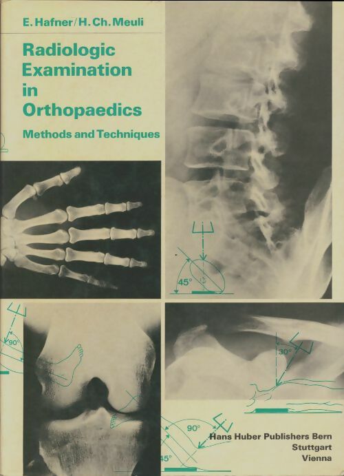 Radiologic examination in orthopaedics - E Hafner -  Hans Huber - Livre