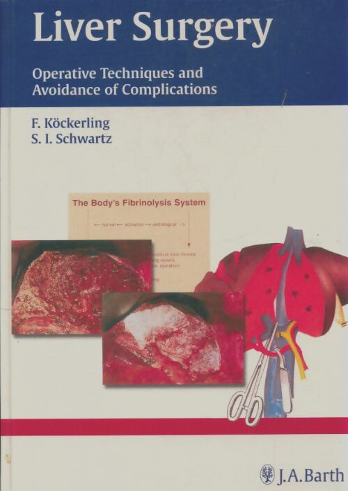 Livrenpoche : Liver surgery : Operative techniques and avoidance of complications - F Köckerling - Livre