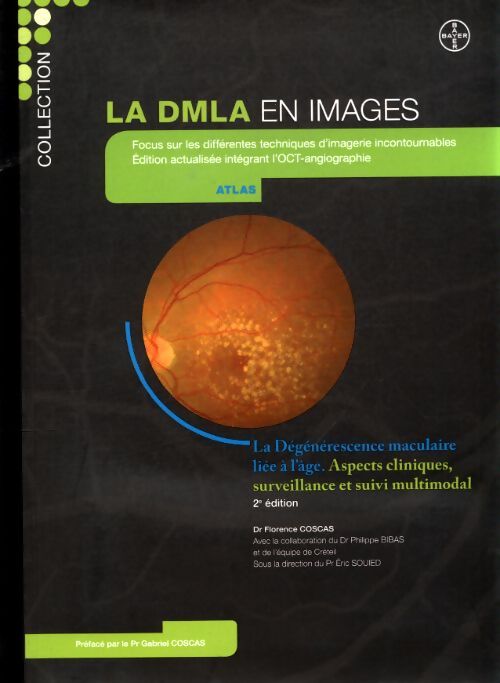 La DMLA en images - Collectif - Livre