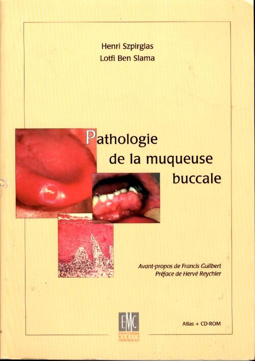 Pathologie de la muqueuse buccale - Collectif - Livre