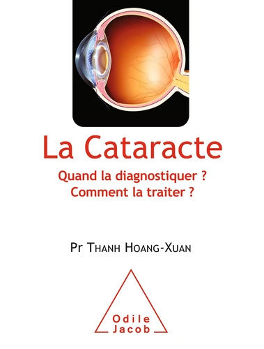 La Cataracte : Quand la diagnostiquer ? Comment la traiter ? - Thanh Hoang-Xuan - Livre